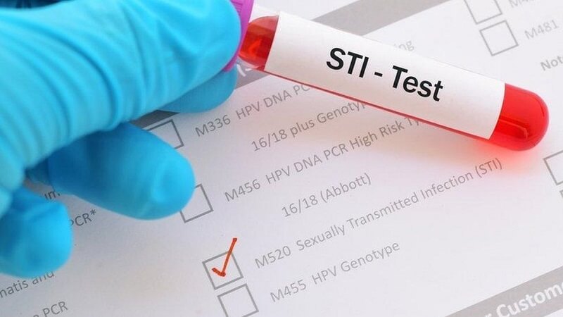 The Case for Multi-Panel STI Testing and Why It Changes What You Actually Know